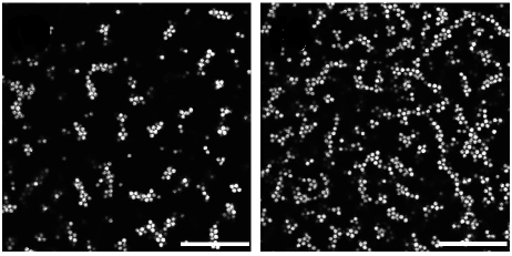 Image obtenue par microscopie confocale d'une suspension colloidale (particules de PMMA)